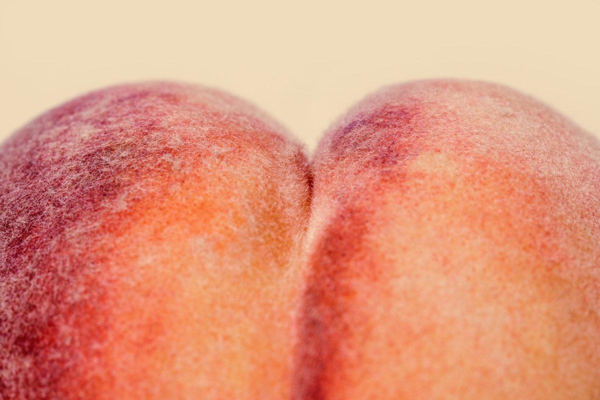 Vanderbilt University Medical Center Performs World’s First Really, Really Fat Ass Transplant