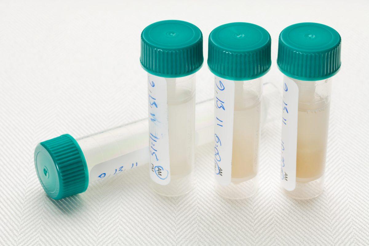 More Spit Needed to Power Dean Bandas’ Glorious Student Cloning Experiment